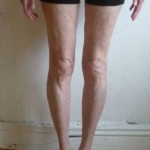 Genny’s Legs In Pattern